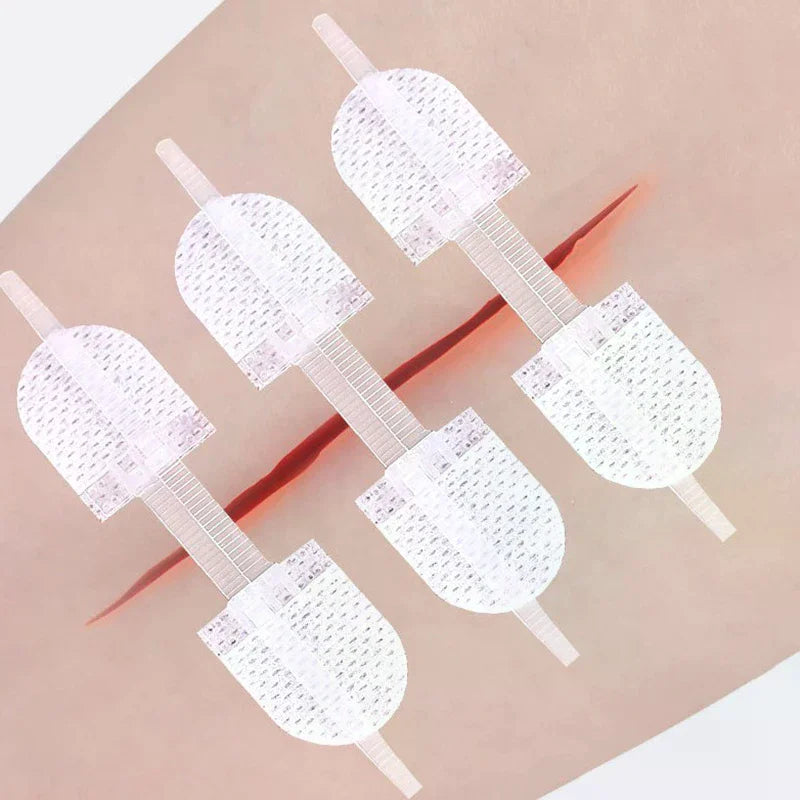 Zipper Wound Closure Patch | Breathable Elastic Bandage Strip Wound Closure Patch QXL