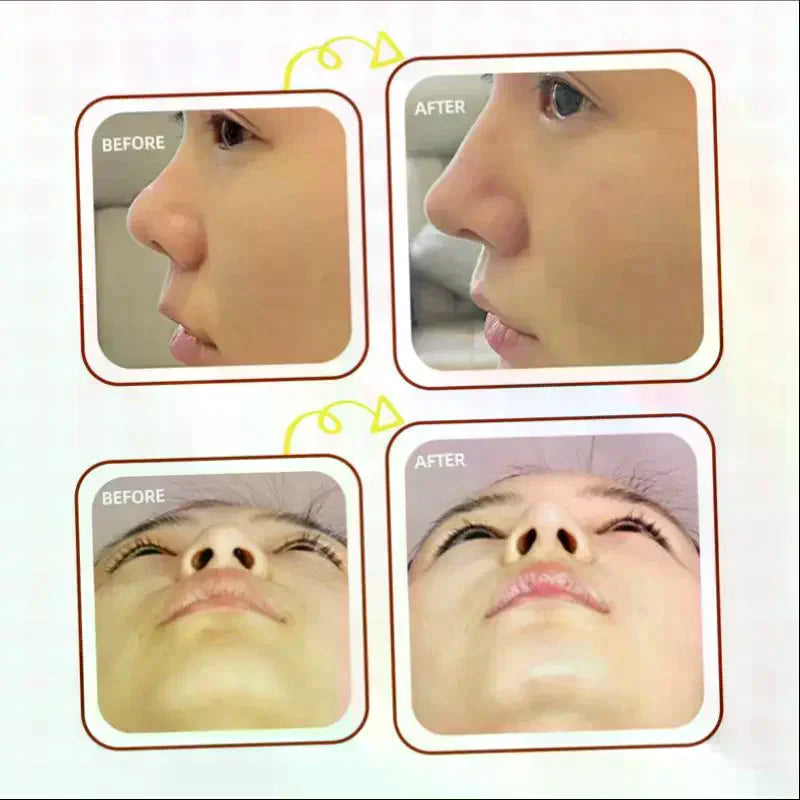 50-Pack Flexible Nose Shaping Strips | Self-Adhesive Patches Nose Shaping Strips QXL