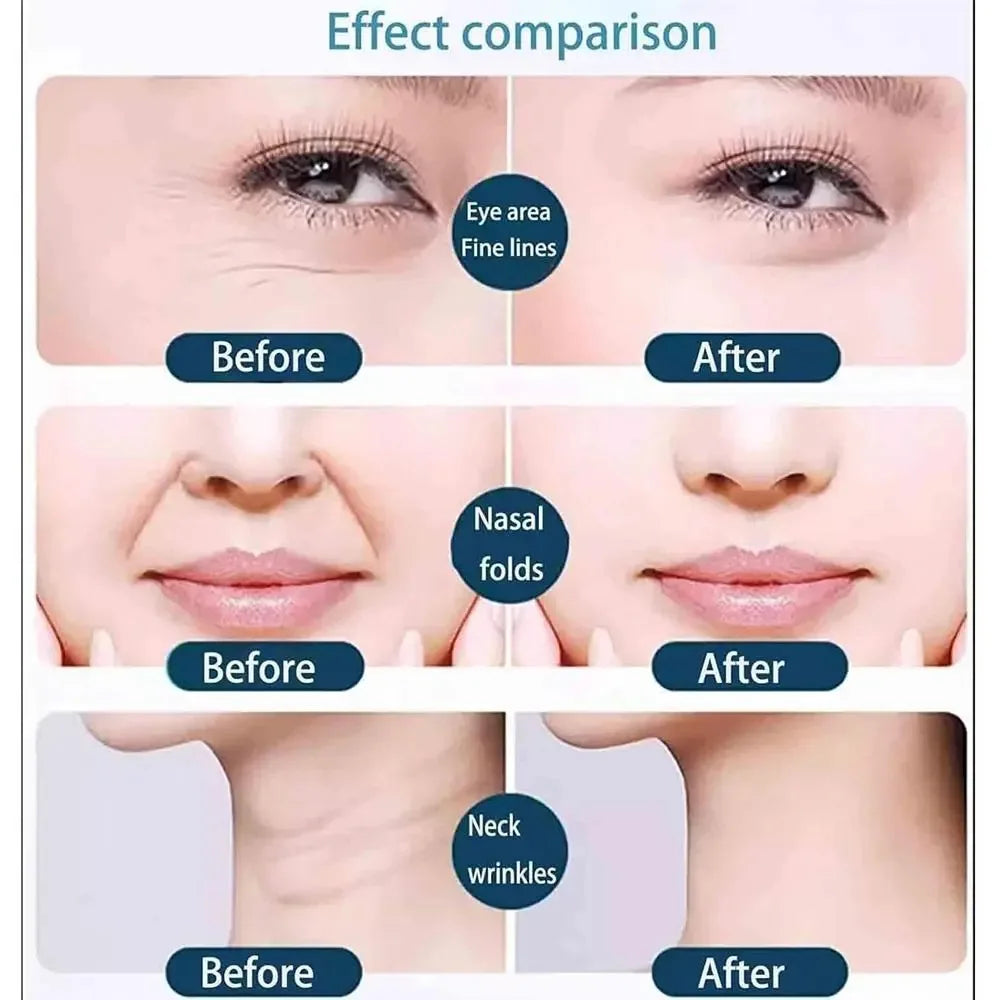 2-Pack Face Lift Tape & Toning Belts | Firming Anti-Wrinkle Face Lift Tape QXL