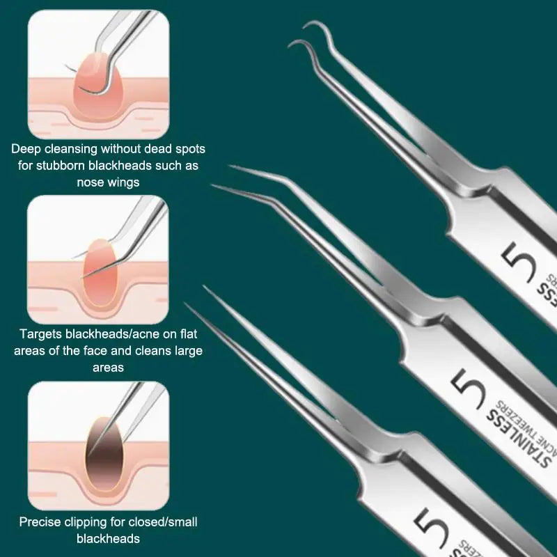 BIOAOUA 7/8-Pc Blackhead Extraction Tool Kit – Stainless Steel Blackhead Extraction Kit QXL