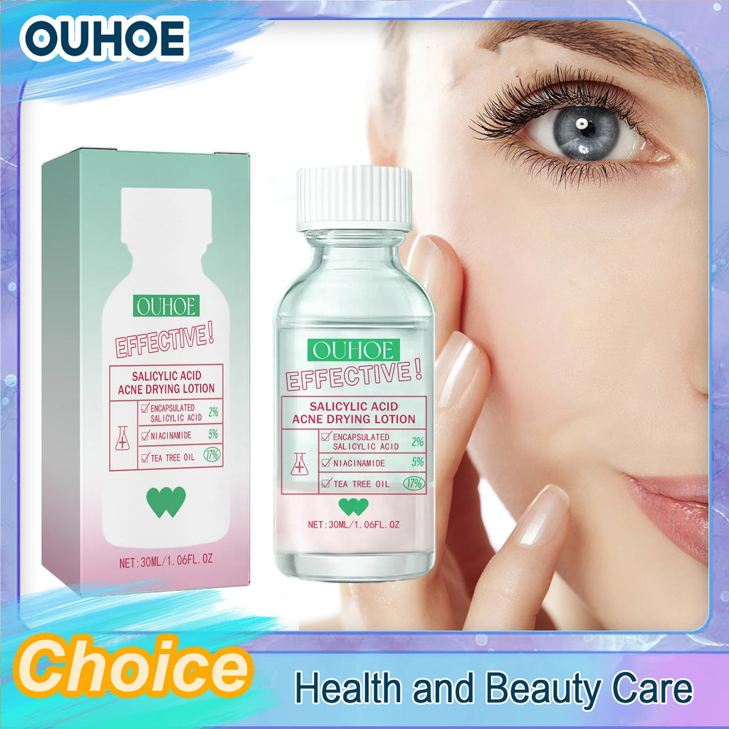 Salicylic Acid Pore-Clearing Acne Solution 30ml | Oil Control Acne Spot Treatment QXL