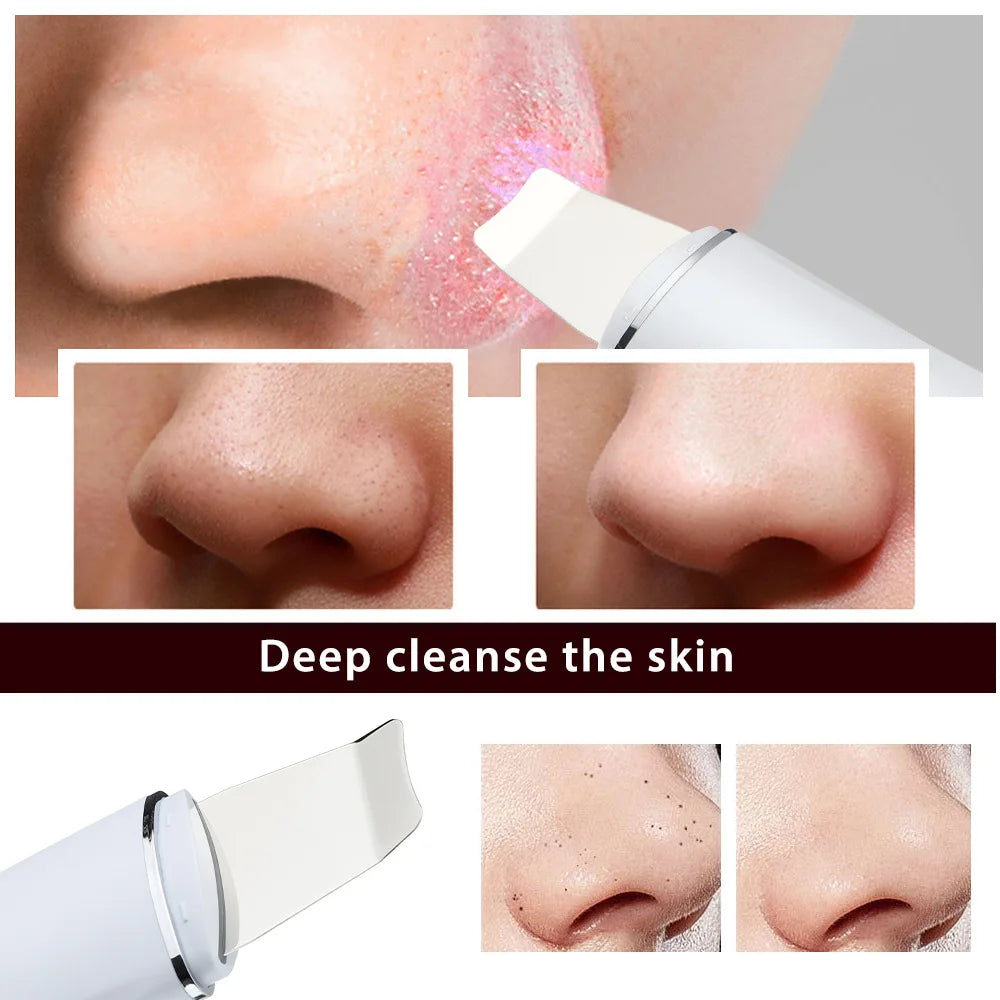 Ultrasonic Skin Scraper | 4-Mode Microcurrent Lifting Device Ultrasonic Skin Scraper QXL