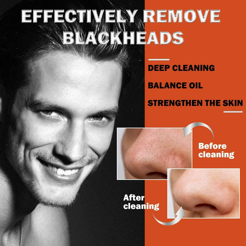 Nose Blackhead Remover Peel-Off Strips | Bamboo Charcoal 10pk Nose Peel-Off Strips QXL