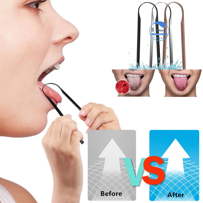 U-Shaped Stainless Steel Tongue Scraper | Fresh Breath Tongue Scraper QXL