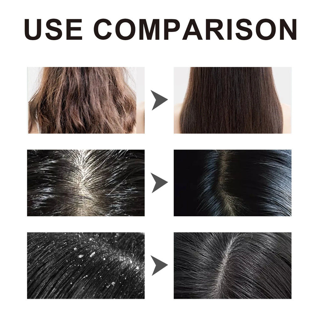 HOEGOA Ginseng Oil Shampoo & Conditioner – All Hair Types Ginseng Hair Shampoo QXL