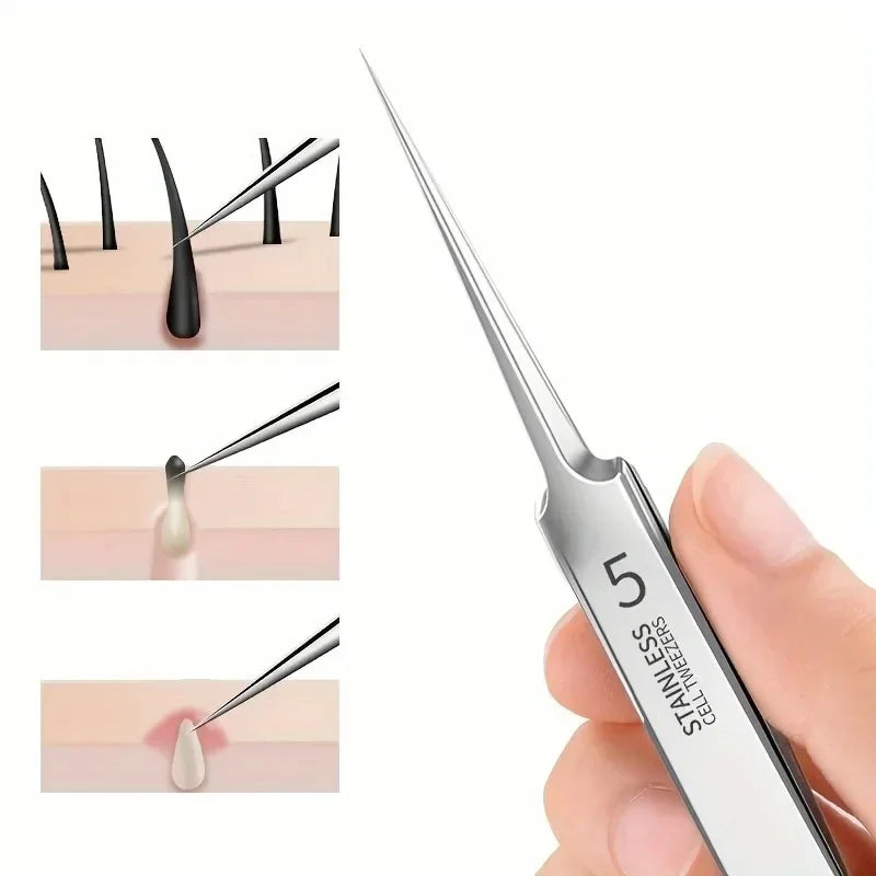 Stainless Steel Blackhead Extractor Set | 1/3 Pcs Comedone Tool Blackhead Extractor Set QXL