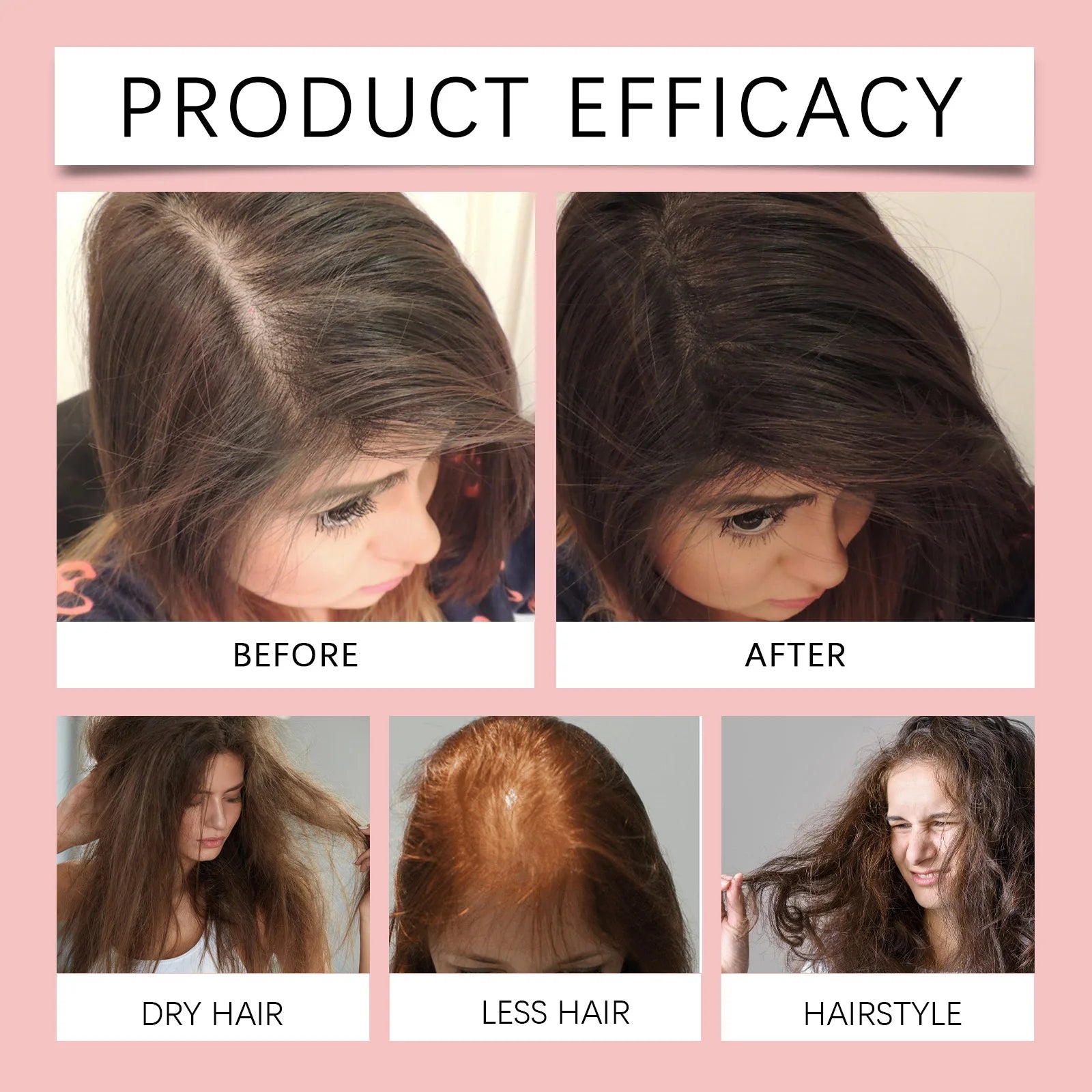 HOEGOA Batana Hair Oil | Organic Hair Mask – 120g Hair Treatment Oil QXL