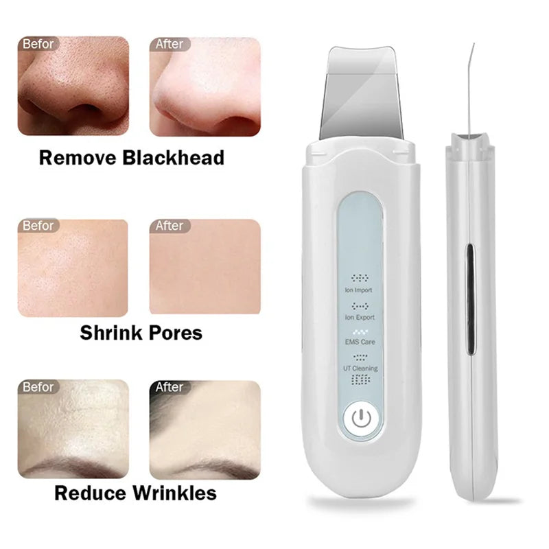 Ultrasonic Skin Scraper – EMS Micro-Current Facial Cleansing Tool Ultrasonic Skin Scraper QXL