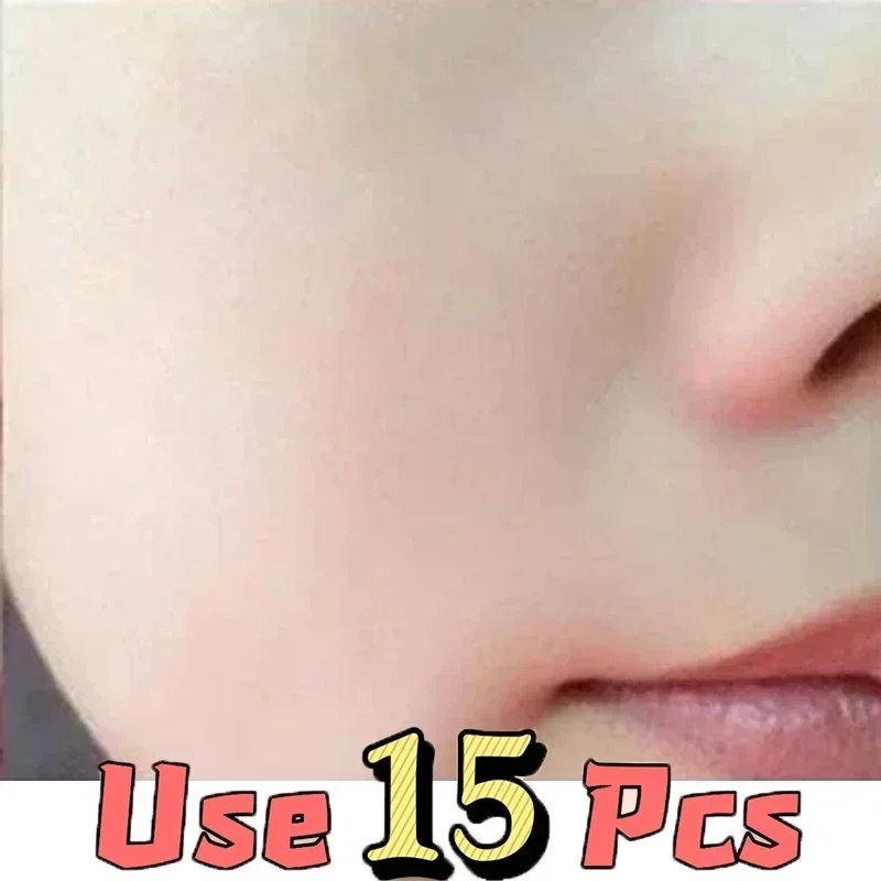 Pore-Minimizing Serum | Oil Control & Brightening Face Gel Face Serum QXL