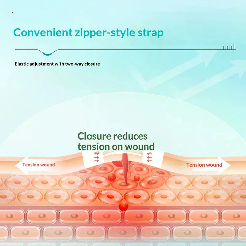 Zipper Wound Closure Patches | Suture-Free Bandage Strips Wound Closure Patch QXL