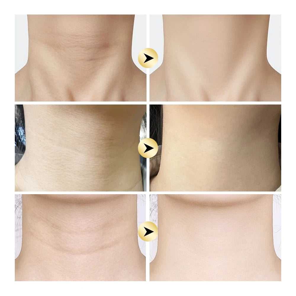 AH-8 Firming Neck Cream with Roller – Lifting & Smoothing Neck Firming Cream QXL