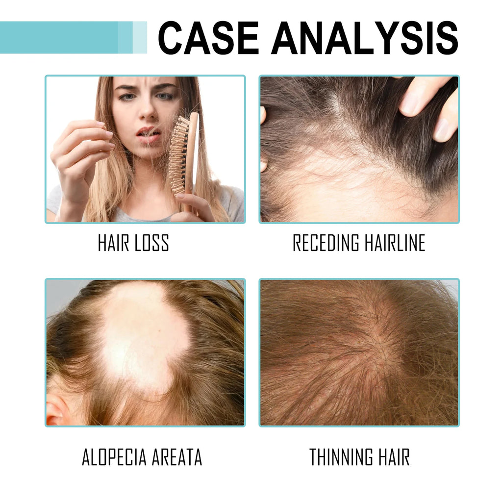 HOEGOA Natural Scalp Serum & Plant Extract Hair Essence Oil Hair Essence Oil QXL