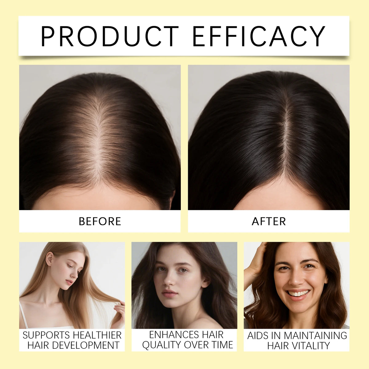 HOEGOA Herbal Hair Density Serum Spray | Scalp & Strength Hair Serum Spray QXL