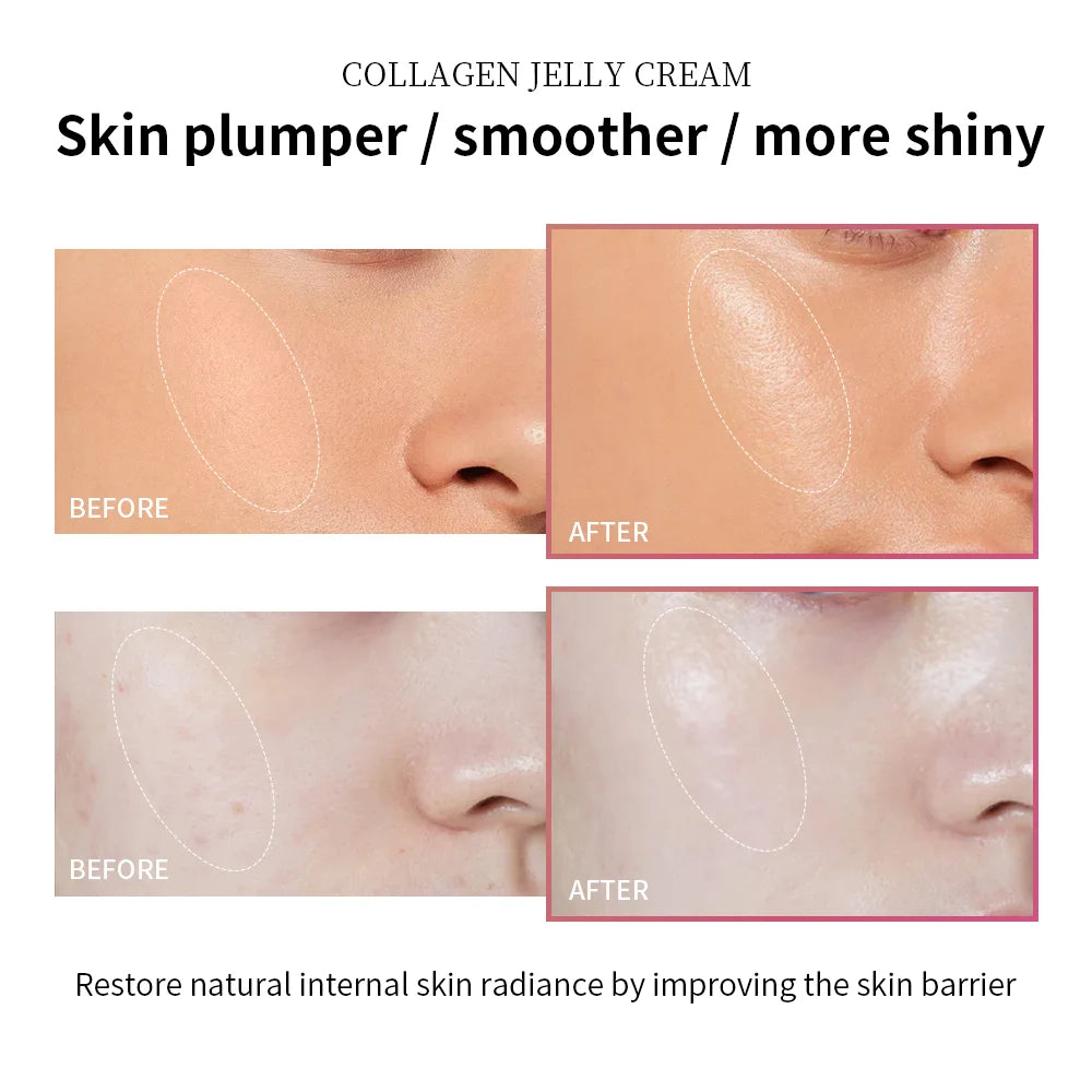 Collagen Jelly Face Cream with Niacinamide 100ml | Firming Gel Face Moisturizing Cream QXL