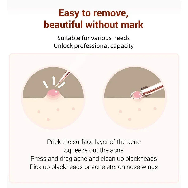 4-Piece Stainless Steel Blackhead & Blemish Removal Tool Set Blemish Extraction Kit QXL