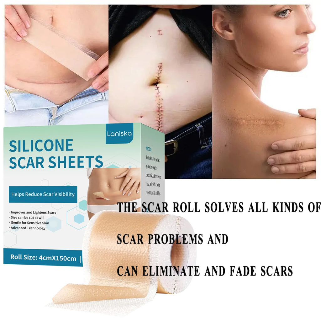 Silicone Scar Sheets Roll 4×150cm | Reusable Scar Tape Silicone Scar Tape QXL