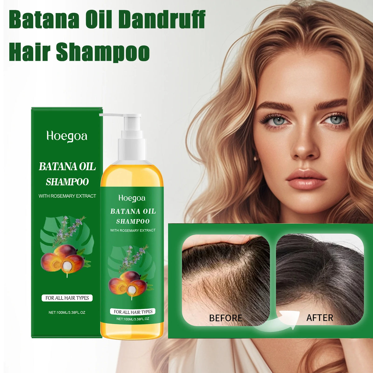 HOEGOA Batana Oil Shampoo – Moisturizing Scalp Cleanser Moisturizing Shampoo QXL