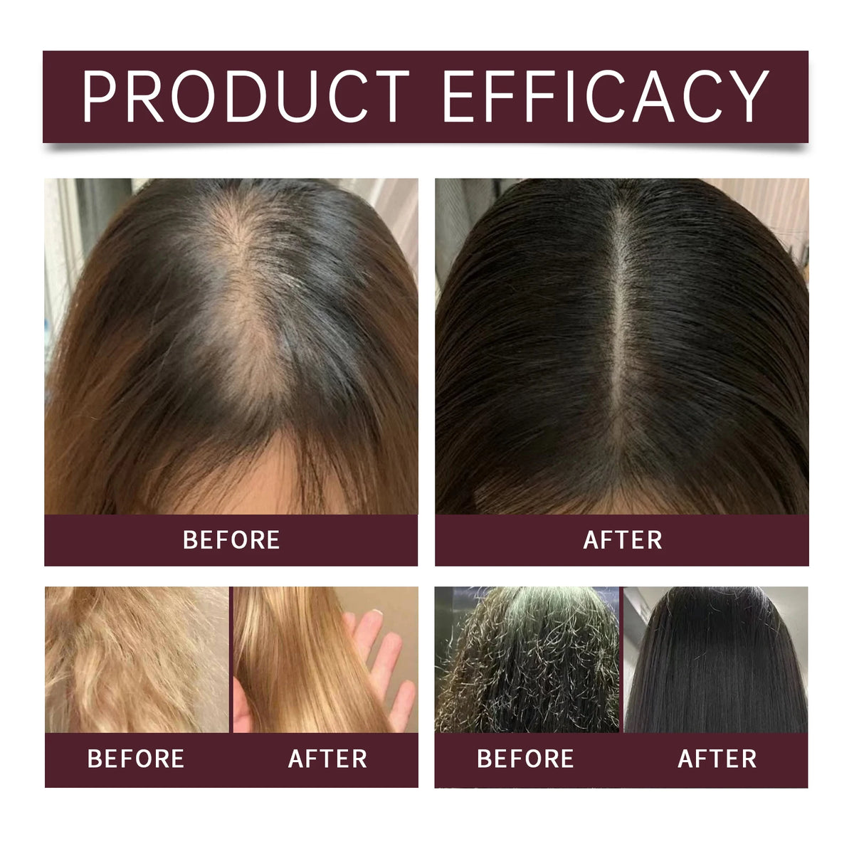 HOEGOA Batana Oil Nourishing Shampoo | Oil Control & Dandruff Nourishing Hair Shampoo QXL