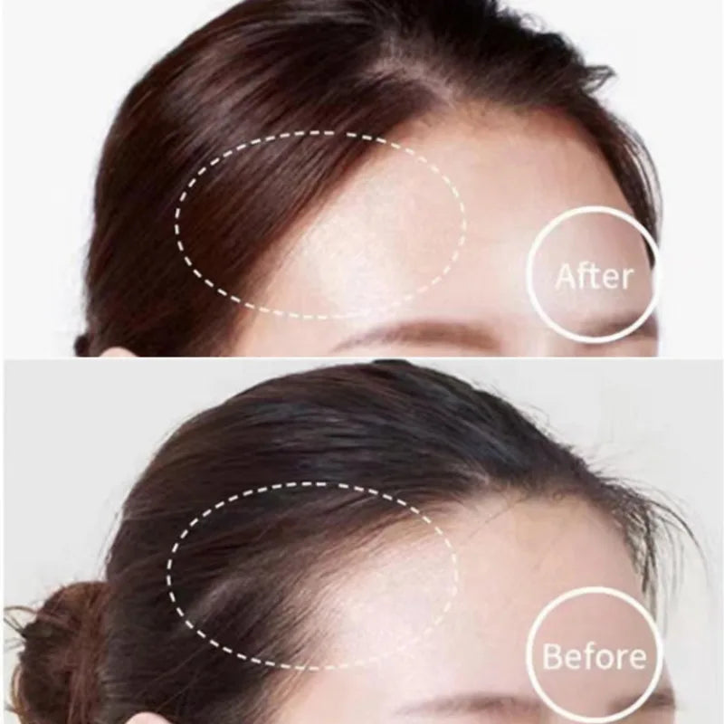 Hairline Contouring Powder Cream – Covers White Hair & Forehead Hairline Contouring Cream QXL