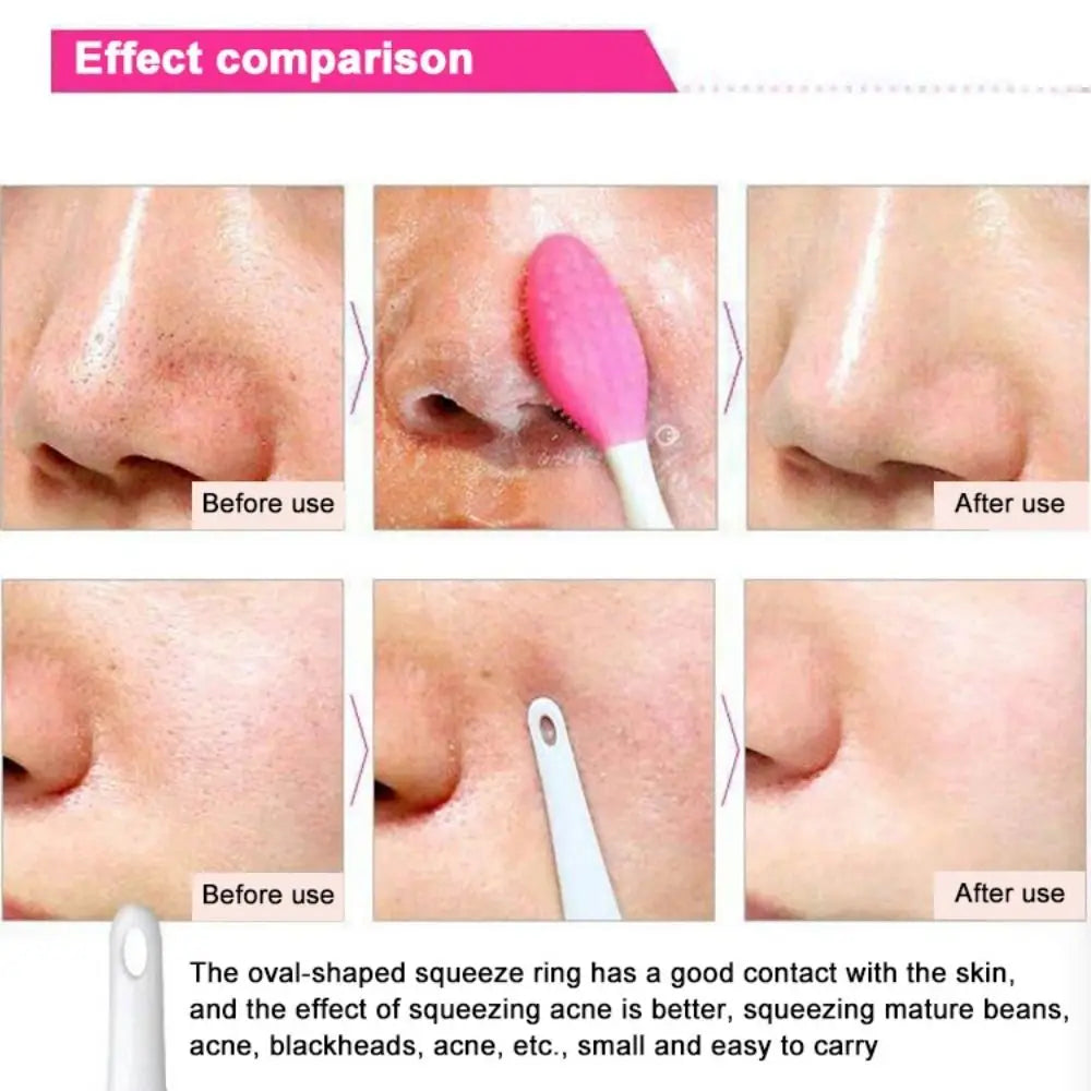 Silicone Nose Cleansing Brush | Manual Blackhead Removal Nose Cleansing Brush QXL