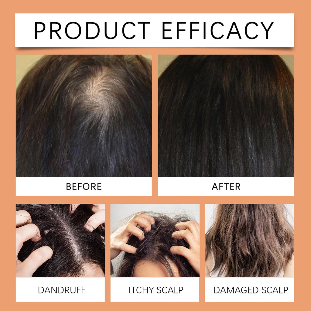 HOEGOA Batana Oil Hair Care – Nourishing Scalp & Moisture Oil Hair Conditioning Oil QXL