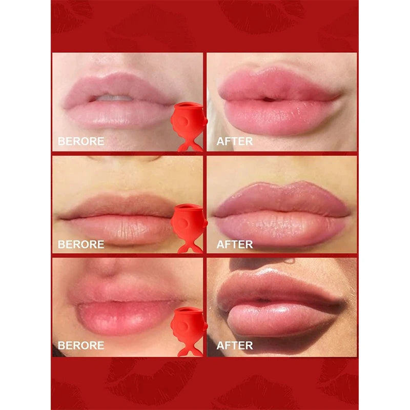 Silicone Lip Plumper & Enlarger Tool – Fuller Glossy Lips Lip Plumper Tool QXL