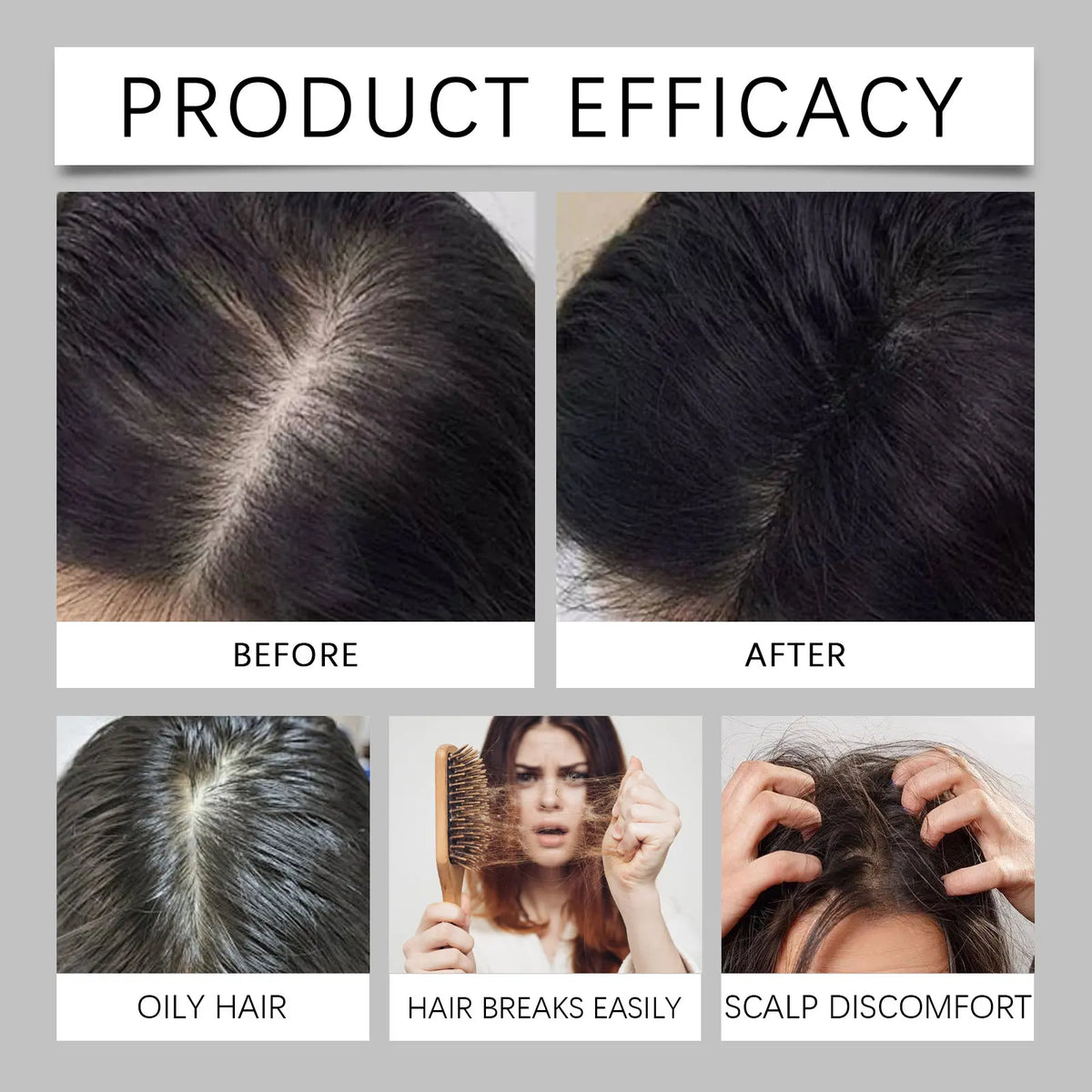 HOEGOA Polygonum & Biotin Hair Spray – Nourish & Strengthen Hair Care Spray QXL