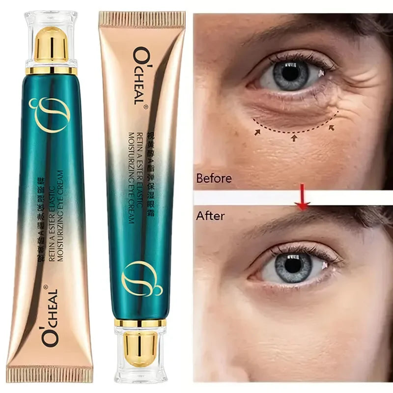 OCHEAL Retinol Eye Cream – Brighten, Firm & Hydrate 30g Eye Cream QXL