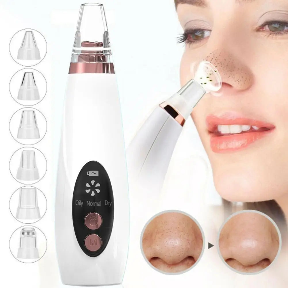 Electric Blackhead Remover | USB Rechargeable 3-Speed Pore Vacuum Pore Vacuum Cleanser QXL