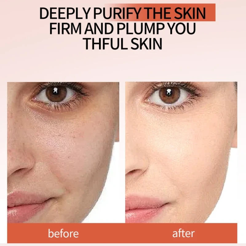 Nicotinamide Peel-Off Night Mask | Deep Moisturizing 75ml Peel-Off Night Mask QXL