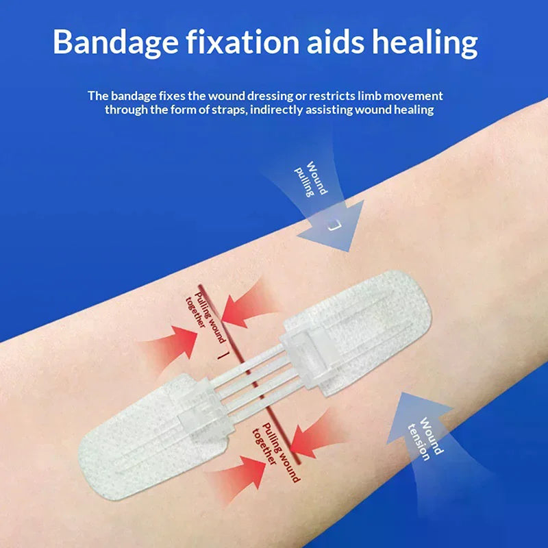 Zipper Wound Closure Patches | Suture-Free Bandage Strips Wound Closure Patch QXL