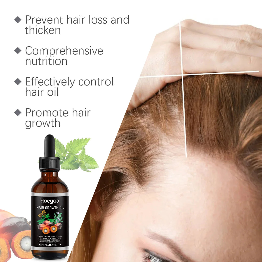 HOEGOA Palm Oil Hair Growth & Scalp Treatment Oil 60ml Scalp Treatment Oil QXL