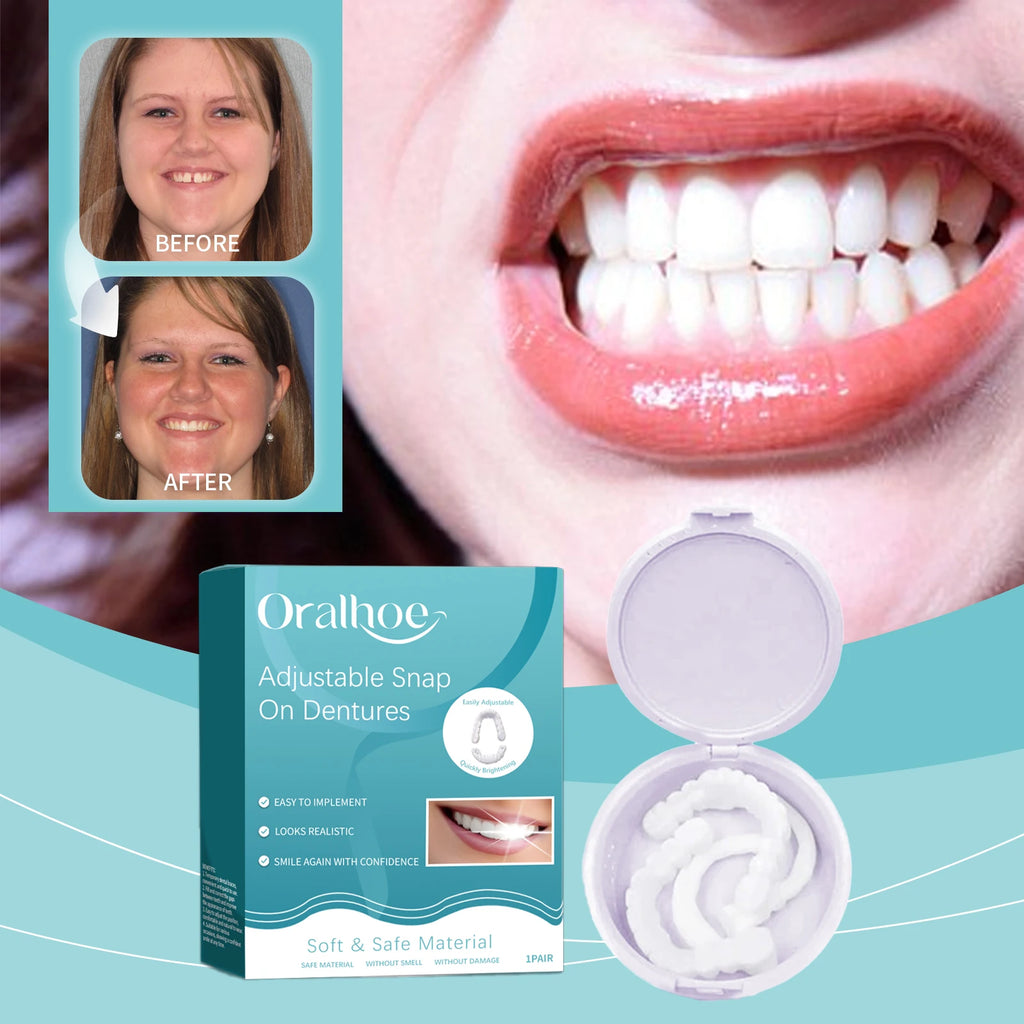 Snap-On Smile Veneers | Adjustable Fake Teeth Cover Set Snap-On Dental Veneers QXL
