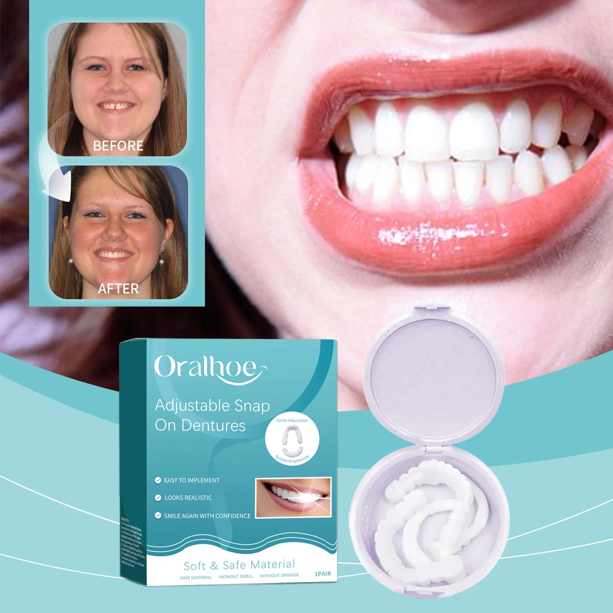 Snap-On Smile Veneers | Adjustable Fake Teeth Cover Set Snap-On Dental Veneers QXL