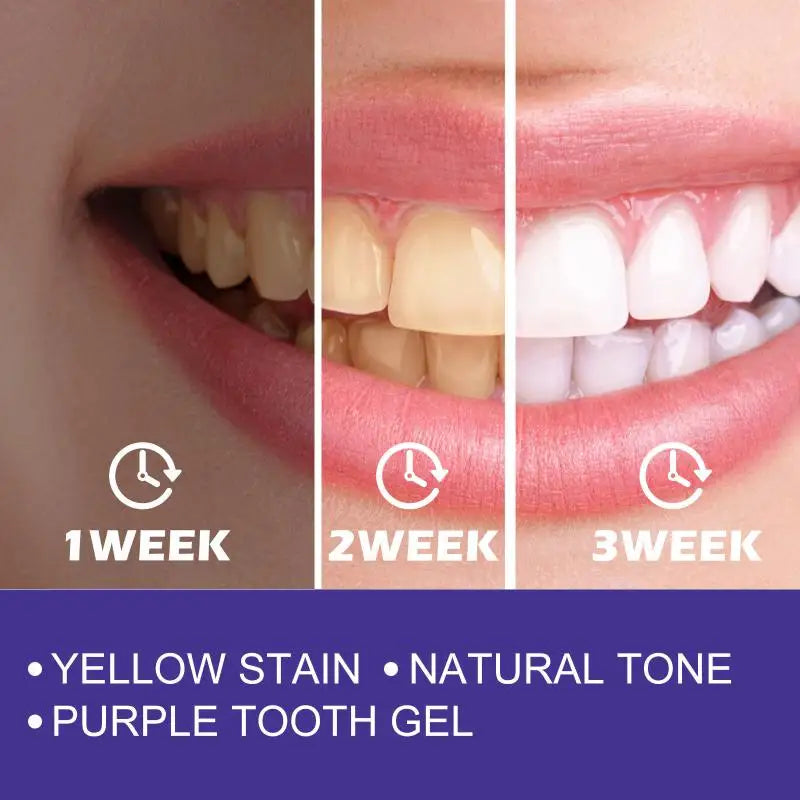 EELHOE Purple Whitening Toothpaste Color-Correcting 30ml Whitening Toothpaste QXL
