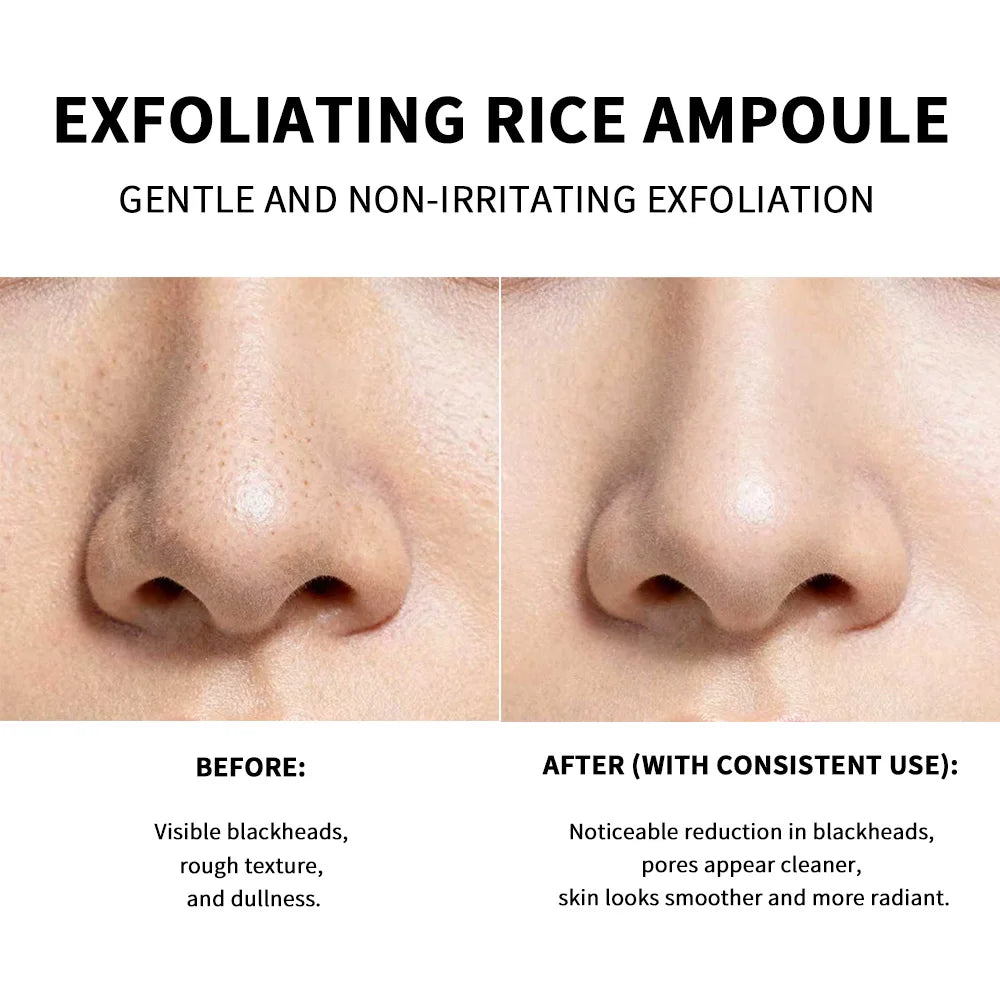 Rice Exfoliating Serum – Brightening & Hydrating Ampoule Exfoliating Serum QXL