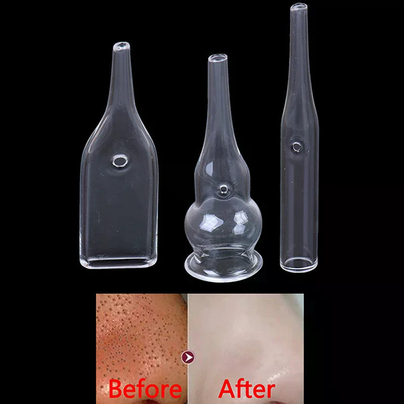 3-Pack Glass Suction Tubes for Blackhead Vacuum Extractor Blackhead Extractor Tubes QXL