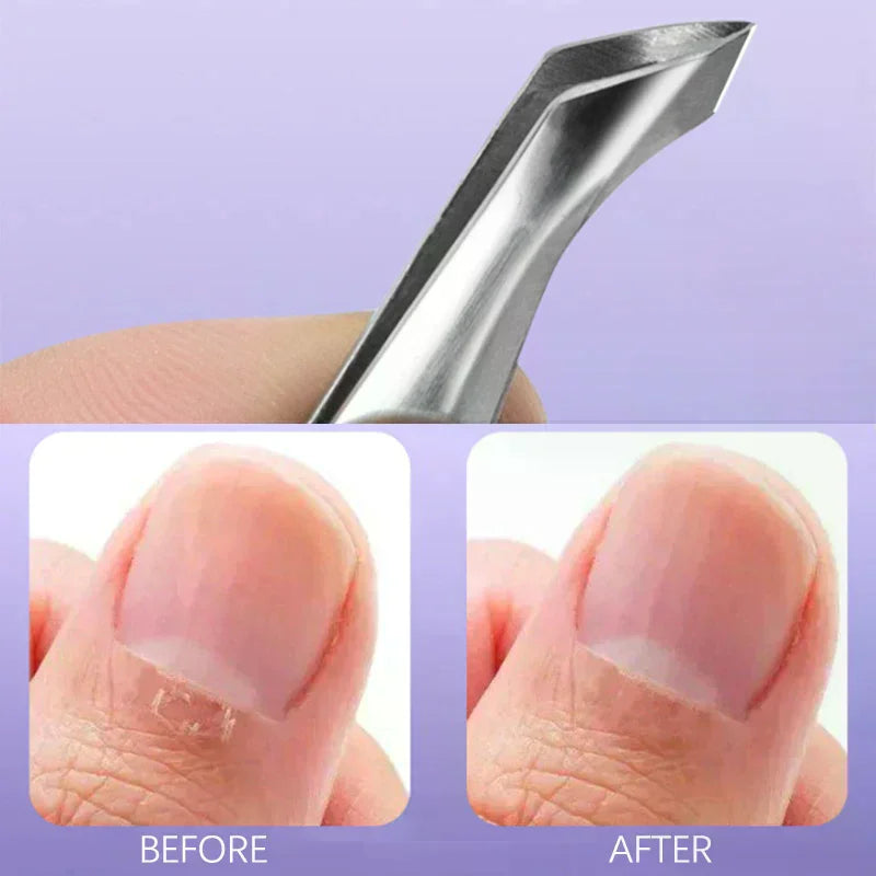 Stainless Steel Nail Cuticle Nipper | Hangnail & Dead Skin Tool Cuticle Nipper QXL