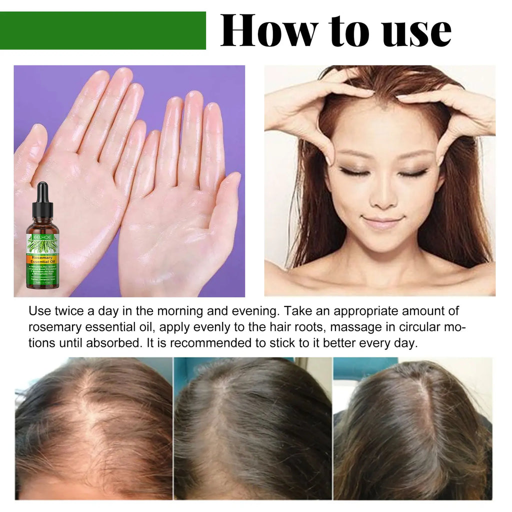 HOEGOA Rosemary Hair Oil – Shine, Frizz Control & Scalp Care Hair Essential Oil QXL