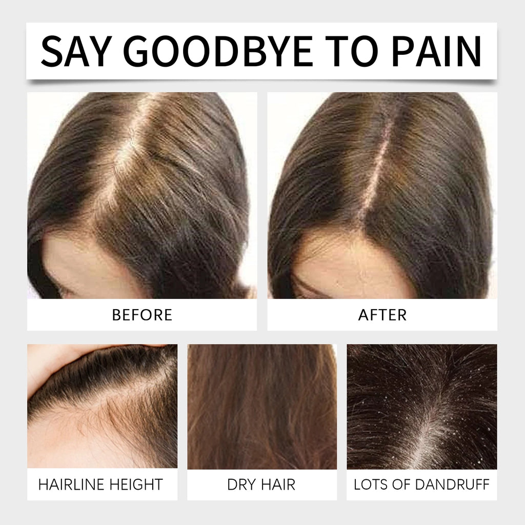 HOEGOA Batana Hair Oil 60ml – Strengthen & Nourish All Hair Types Hair Treatment Oil QXL