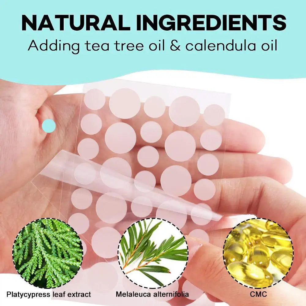 Hydrocolloid Pimple Patches with Tea Tree Oil | 72 or 288 Pack Acne Pimple Patches QXL