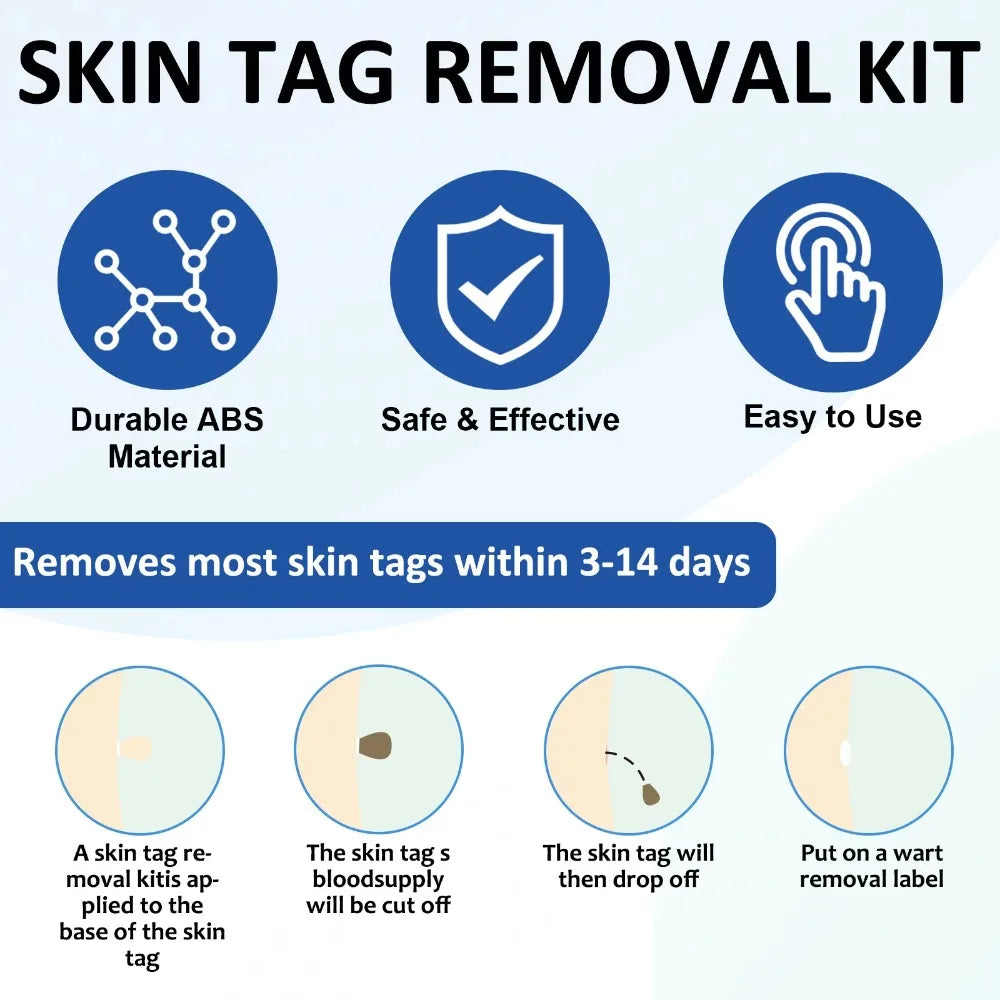 2-in-1 Skin Tag Remover Kit | 60 Bands, 1–9mm Skin Tag Remover QXL