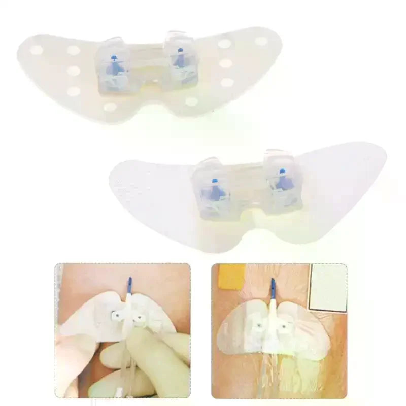 Catheter Fixation Sticker | Foam Tube Leg Retainer Holder Catheter Fixation Holder QXL
