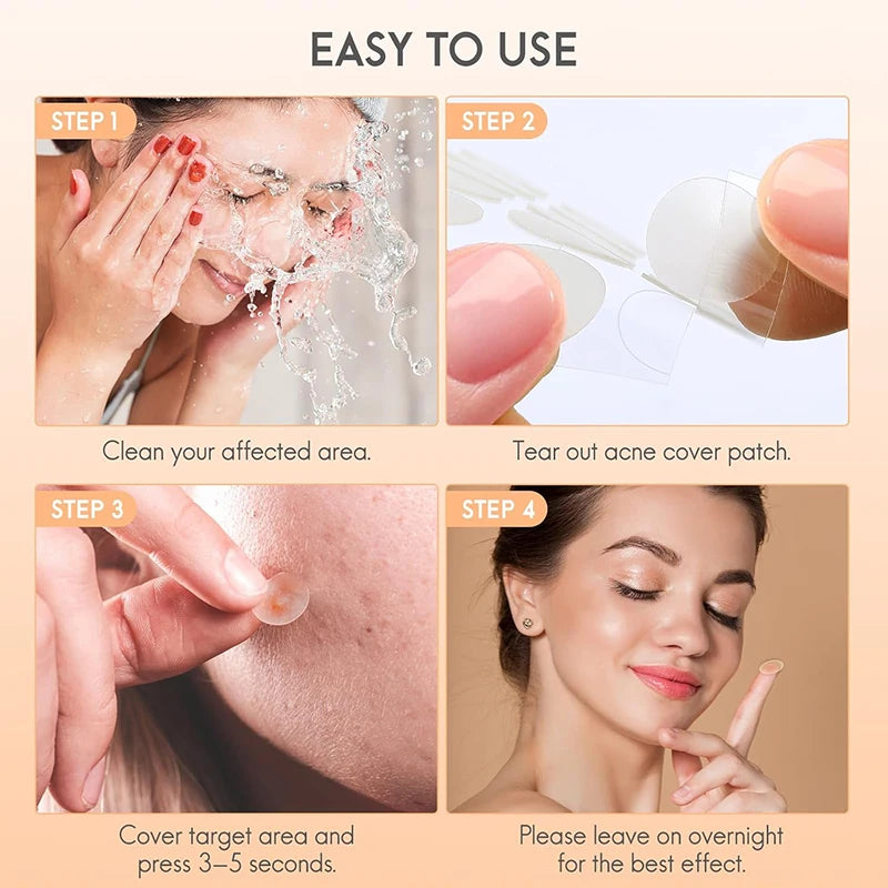 128-Pc Invisible Pimple Patches | Colorful Acne Cover Stickers Acne Pimple Patches QXL