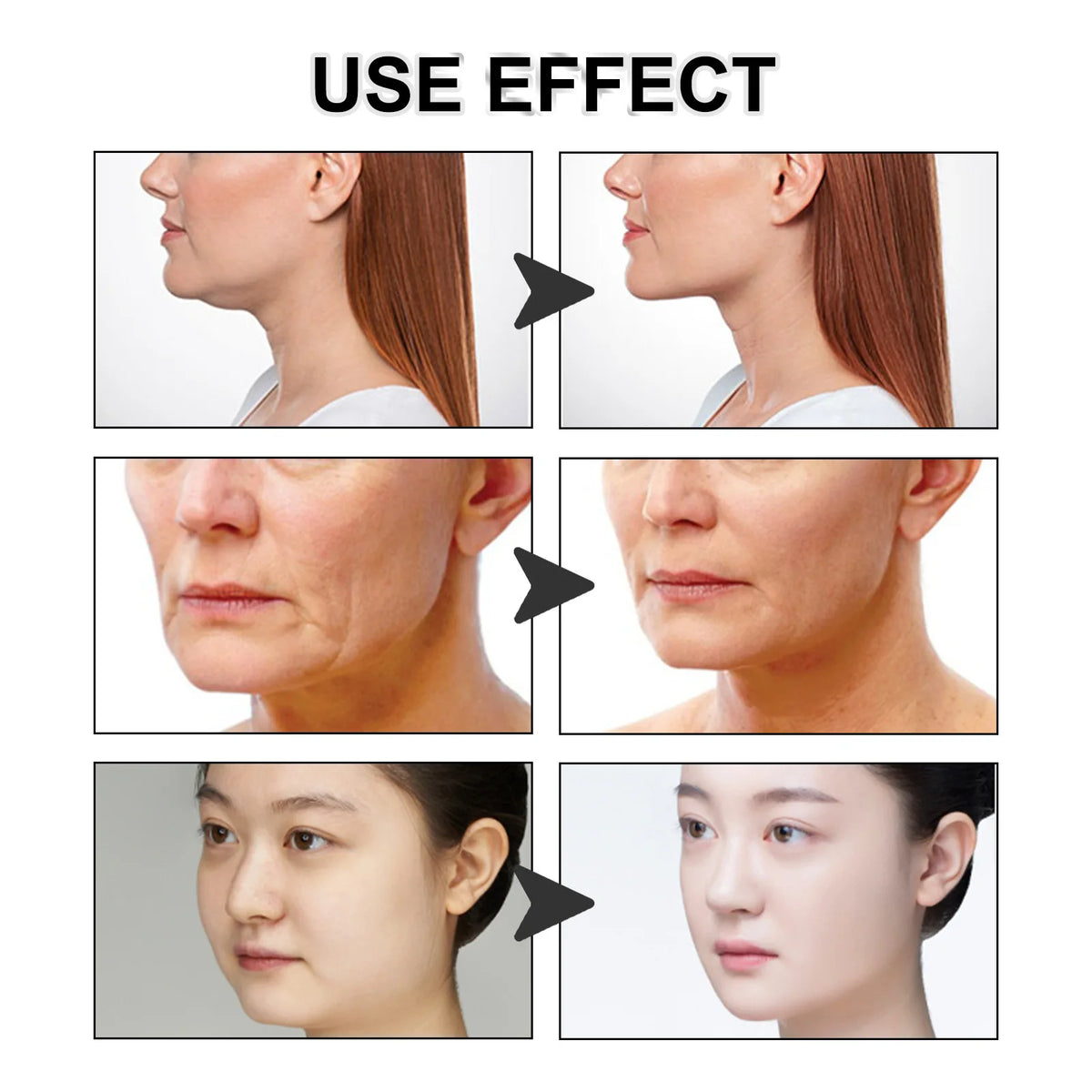 Facial Lifting Chin Patches – V-Shape Face Contouring Tape Facial Lifting Patch QXL