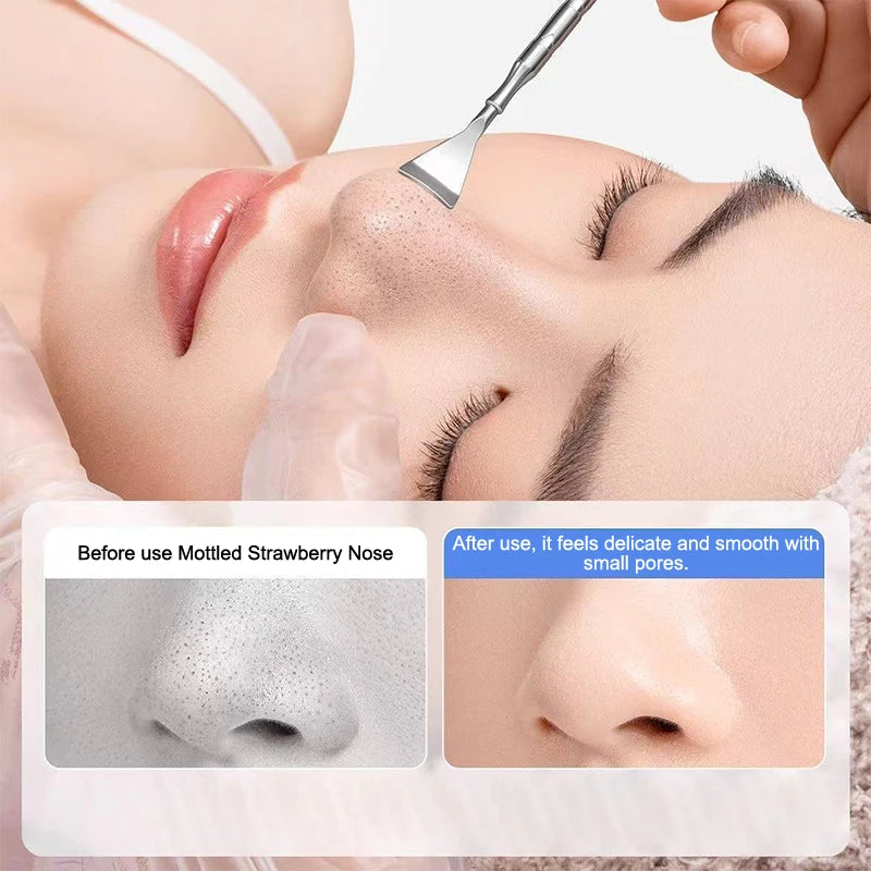 Blackhead Extractor Tool Set | Spatula & Acne Needle Blackhead Extractor Tool QXL