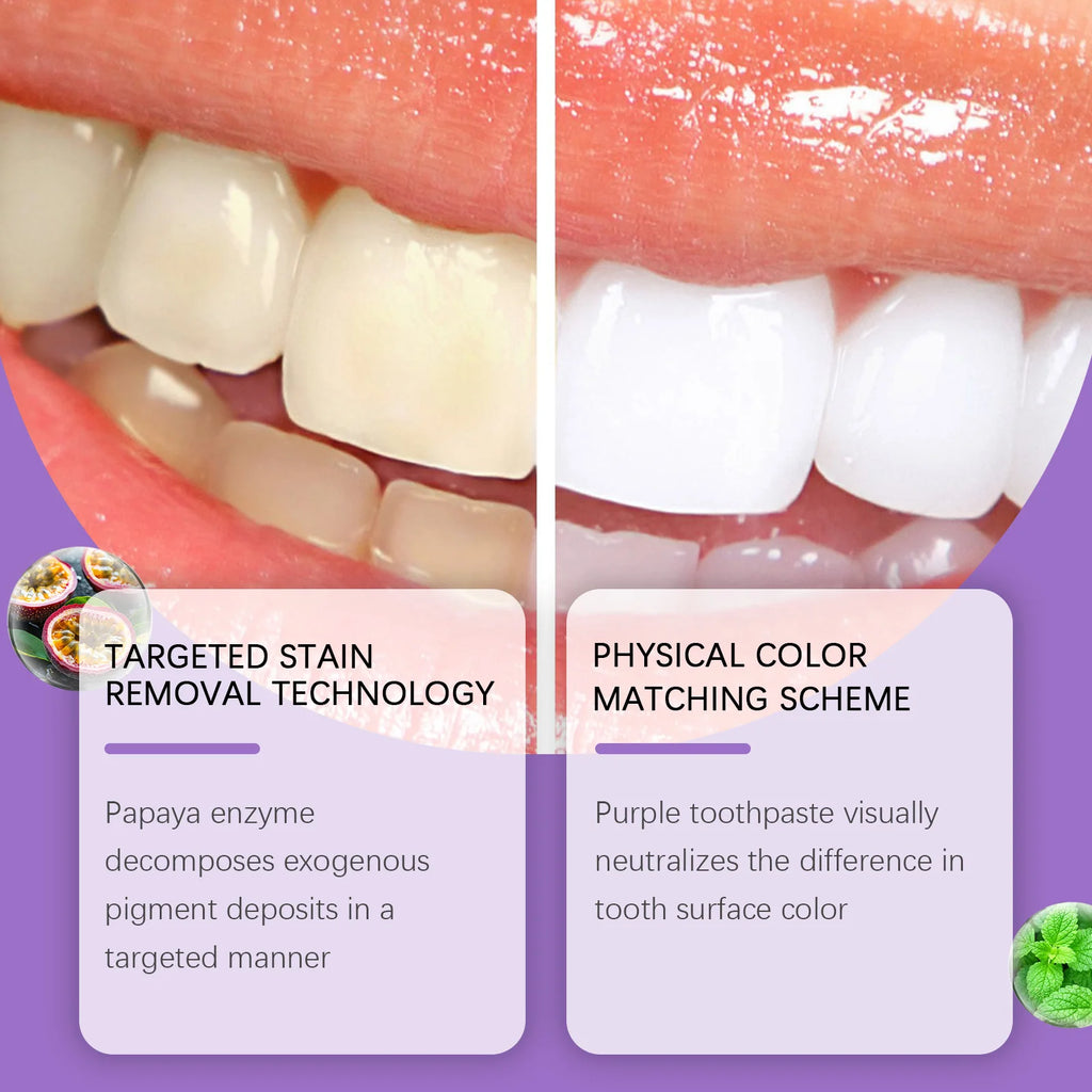 Oralhoe Hydroxyapatite Purple Toothpaste | Whitening Mint 114g Whitening Toothpaste QXL