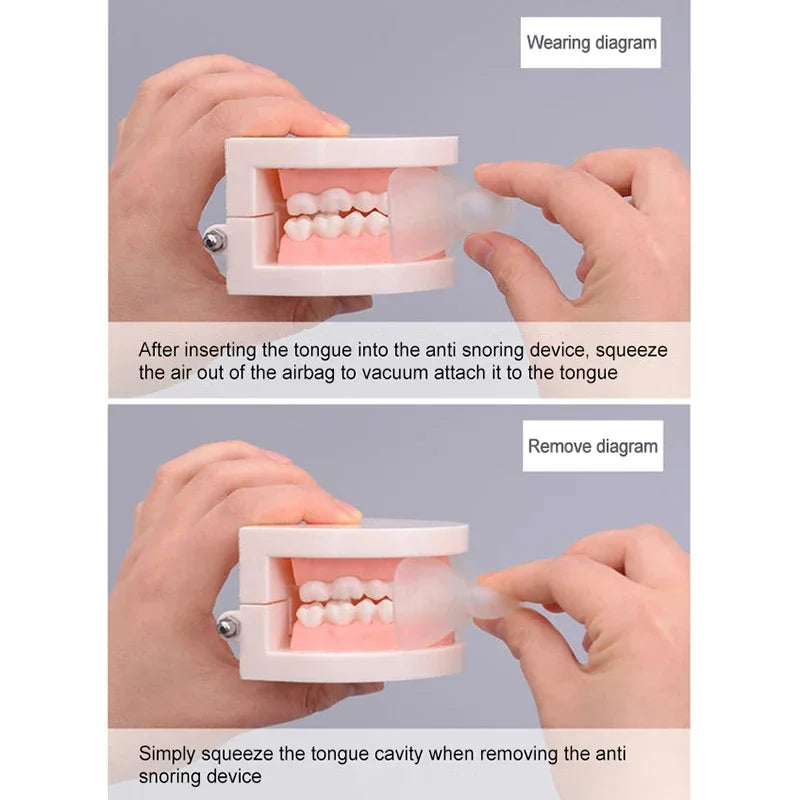 Silicone Tongue Stabilizing Mouthpiece | Anti-Snoring Guard Anti-Snoring Mouthpiece QXL
