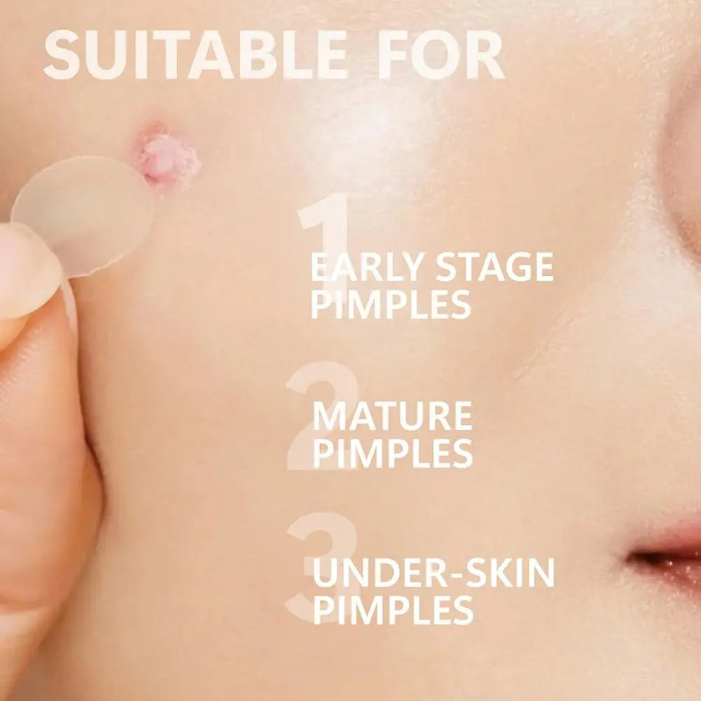 24-Pack Invisible Microneedle Blemish Patches for Face Spots Microneedle Blemish Patches QXL