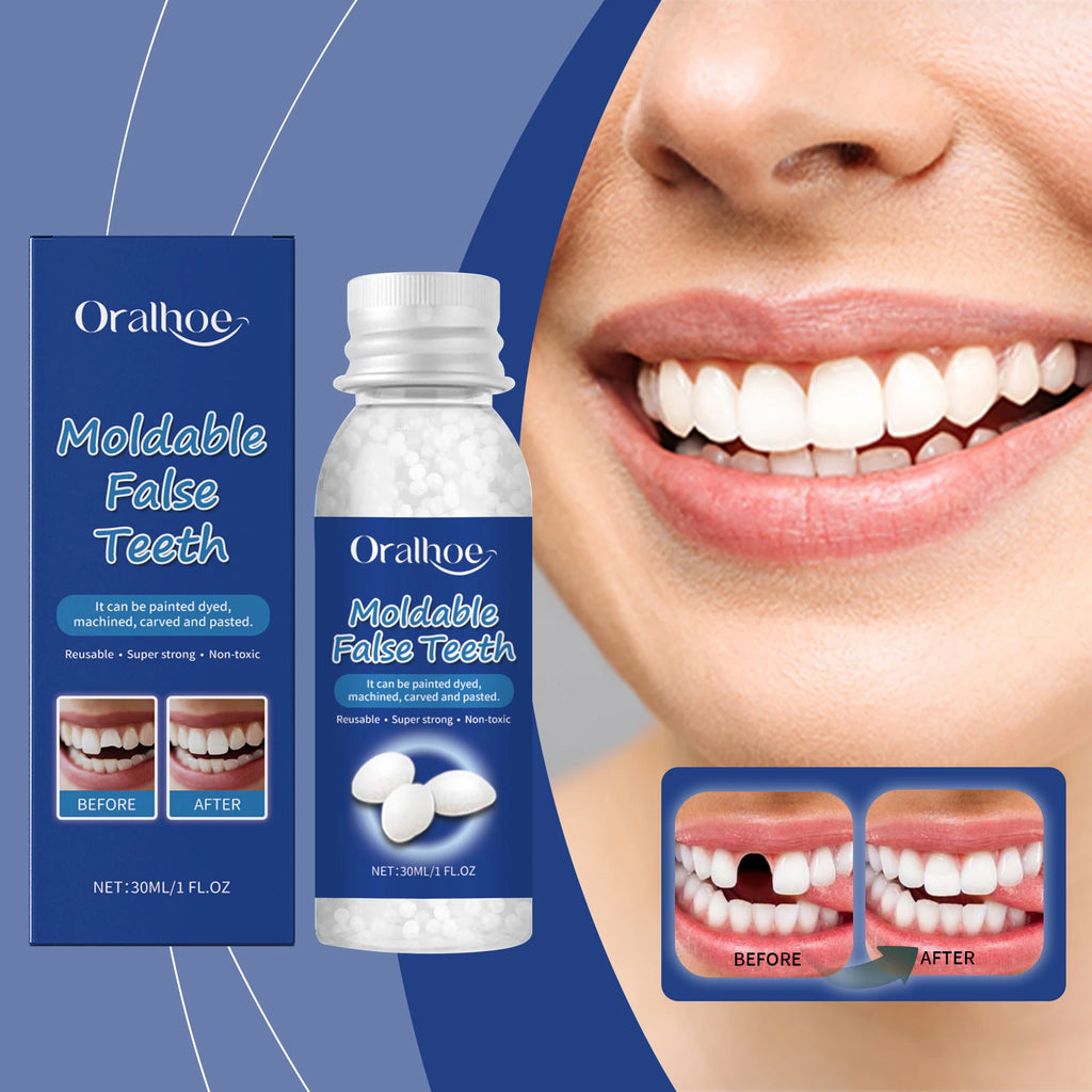 Moldable Temporary Tooth Repair Kit | DIY Denture Adhesive Beads Denture Repair Kit QXL